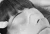 kuehlung-nach-augenlidkorrektur Nach der Augenlid OP werden die Augen gekühlt